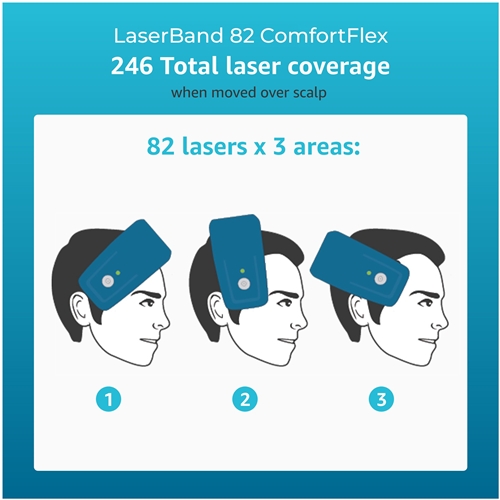 Hairmax LaserBand 82 ComfortFlex | The FreedomStore